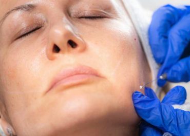 COMO MELHORAR A DEFINIÇÃO DO CONTORNO MANDIBULAR